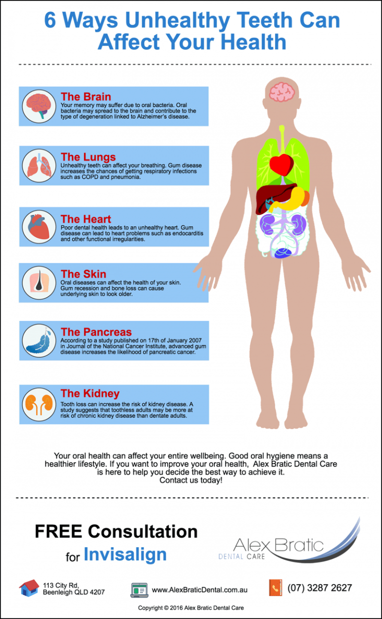 6 Ways Unhealthy Teeth Can Affect Your Health