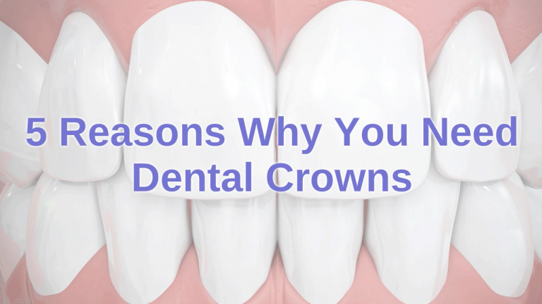 5 Reasons Why You Need Dental Crowns