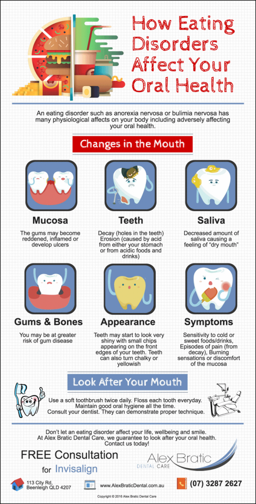 beenleigh-dentist-trivia-how-eating-disorders-affect-your-oral-health